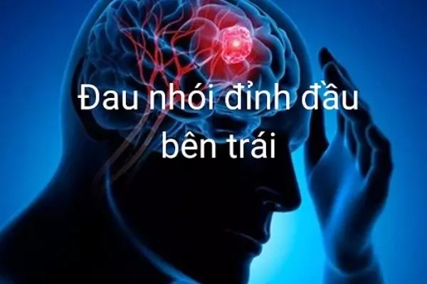 Cách phòng ngừa đau đỉnh đầu bên trái