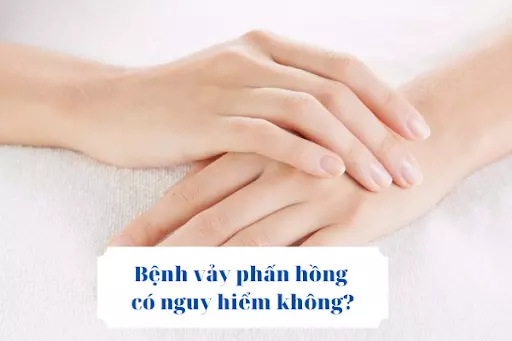 Bệnh vảy phấn hồng có nguy hiểm không? TÌM HIỂU NGAY