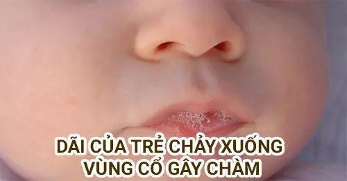 sua-do-an-thua-nuoc-dai-cua-tre-so-sinh-chay-xuong-vung-co-gay-benh-cham.webp