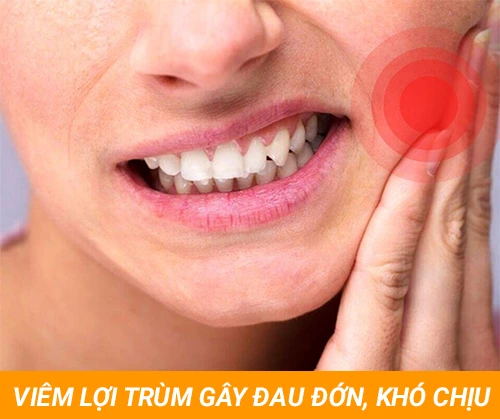 Viem-loi-trum-gay-dau-don-cho-nguoi-mac.webp