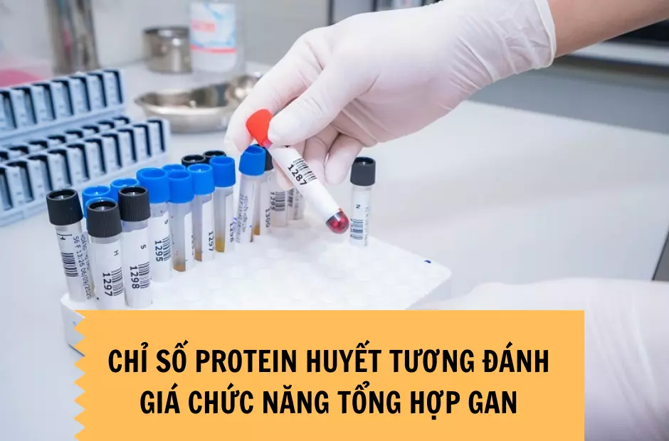 Xet-nghiem-cac-chi-so-protein-huyet-tuong-de-kiem-tra-chuc-nang-tong-hop-gan
