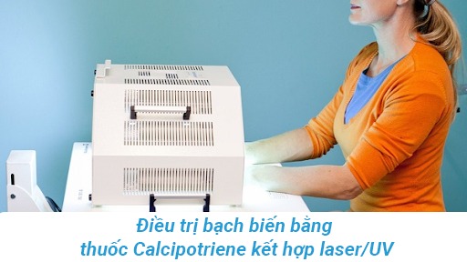 Kết hợp calcipotriene tại chỗ và liệu pháp quang hóa trong điều trị bạch biến