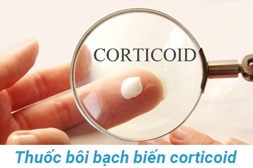 Thuốc bôi corticoid giúp người bệnh bạch biến dần lấy lại sắc tố da