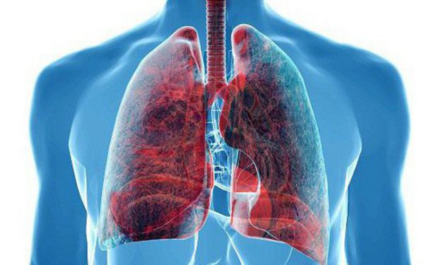 Người bệnh vẩy nến có nguy cơ cao bị bệnh phổi
