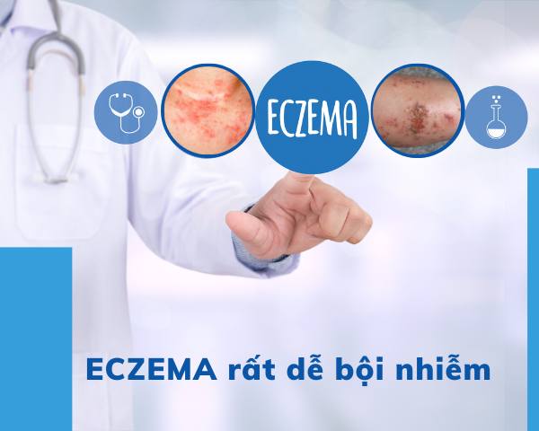 Eczema bội nhiễm
