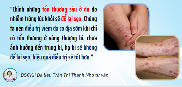 BSCKII Da liễu Trần Thị Thanh Nho cho biết