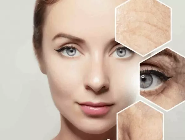 Nếp nhăn dưới mắt là biểu hiện của quá trình lão hóa da
