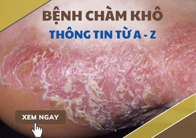 Thông Tin Hữu Ích Khác