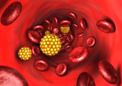 Phác đồ điều trị rối loạn lipid máu hiện nay là gì?