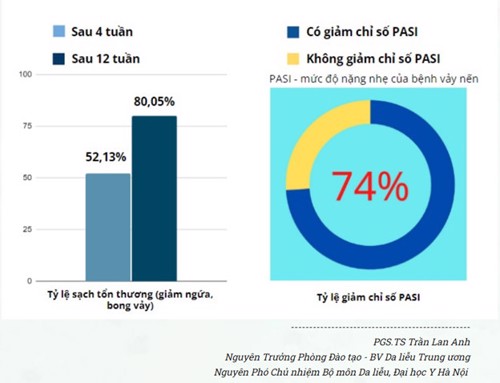 Nghiên cứu hiệu quả hỗ trợ điều trị bệnh vẩy nến bằng Kim Miễn Khang